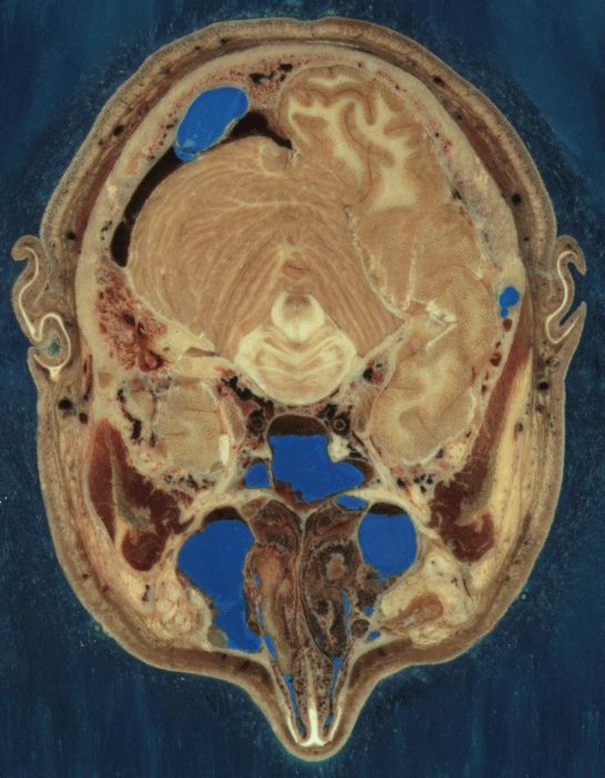 NLM_Visible_Human_Project_-_Section_through_the_head_of_a_human_male